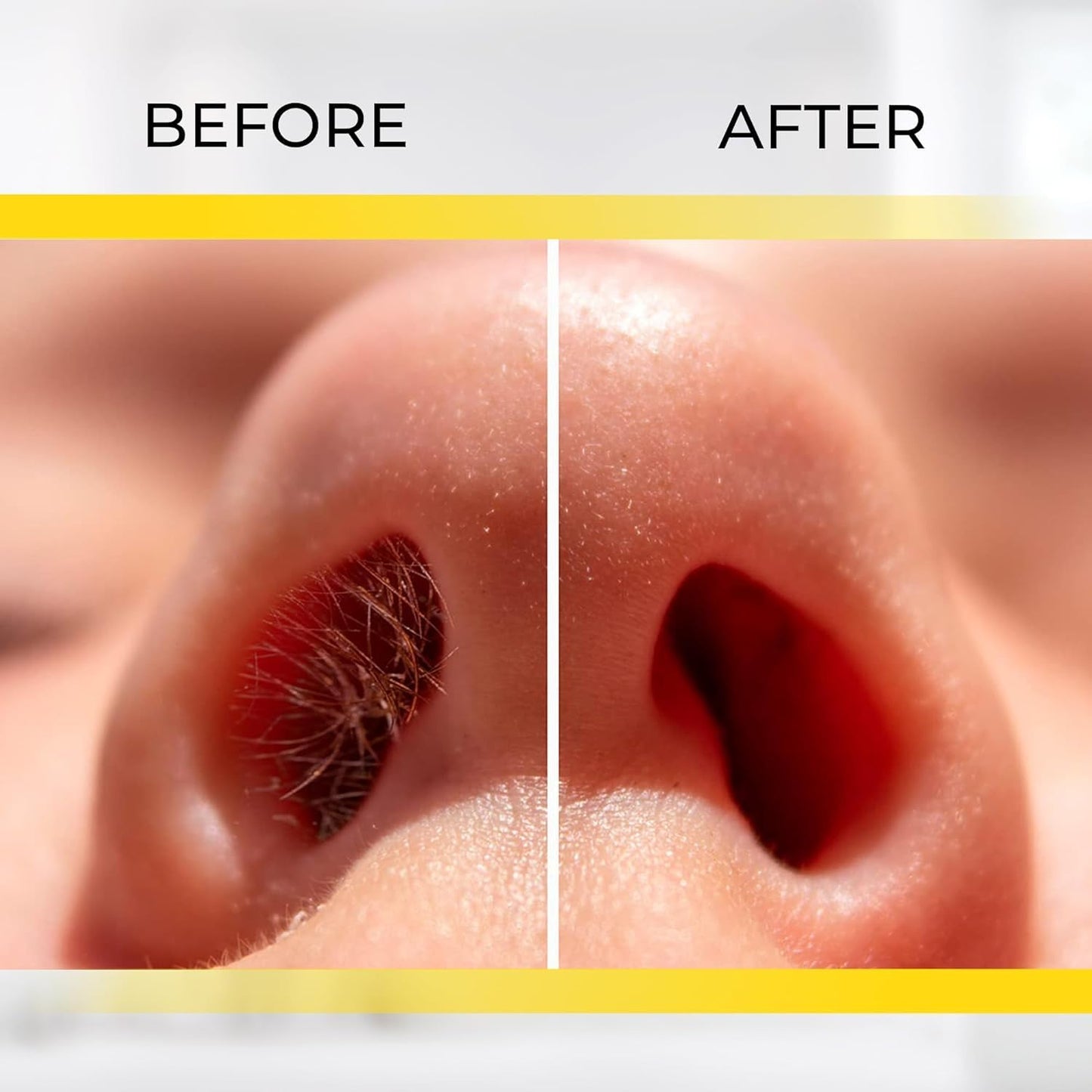 Manual Nose & Ear Hair Clipper Trimmer for Men & Women - Stainless Steel Painless Nose Hair Trimmer with Storage Case and Cleaning Brush