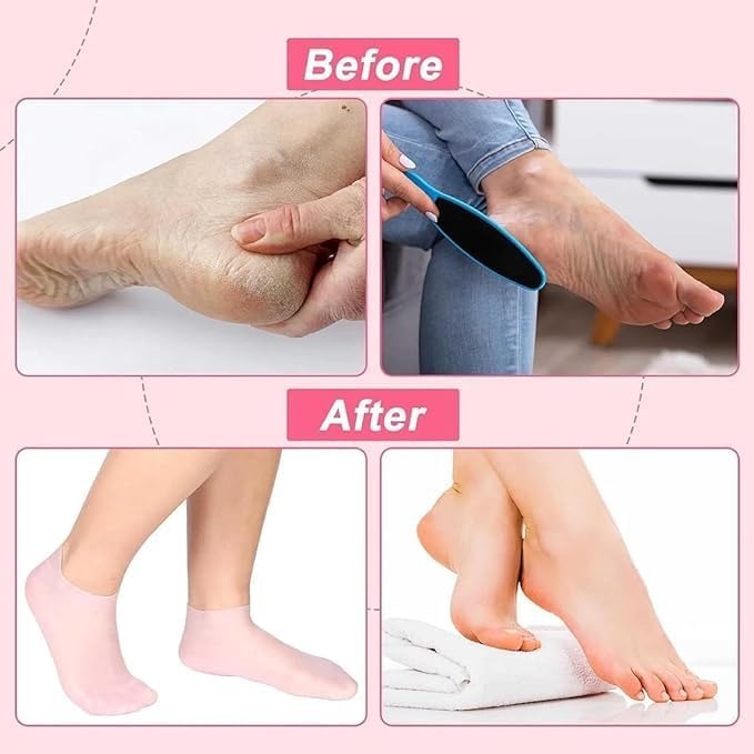 Silicone Gel Moisturizing Socks for Cracked Heels – Reusable Hydrating Spa Socks for Dry Feet, Heels & Callus Repair