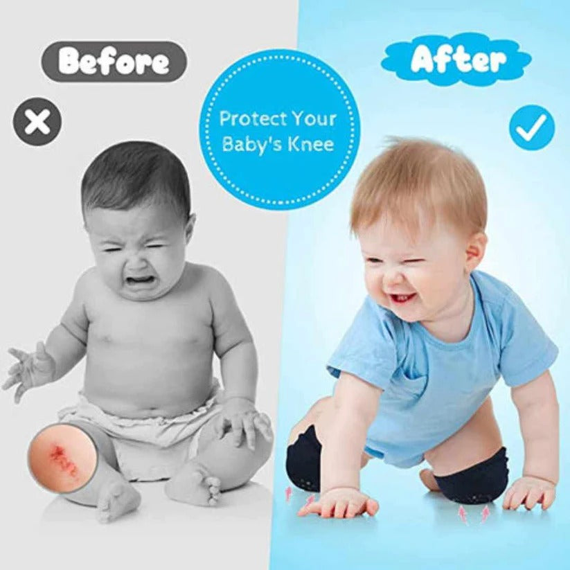 Baby Knee Pads for Crawling, Anti-Slip Padded Stretchable Elastic Cotton Soft Breathable Comfortable Knee Cap Elbow Safety Protector(Random Color)